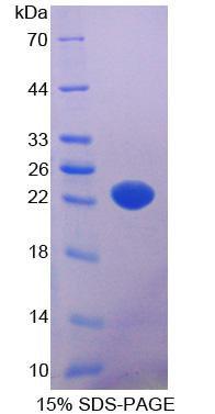 Recombinant Sphingosine 1 Phosphate Lyase 1 (SGPL1)