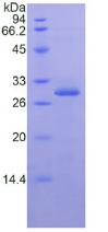 Recombinant Inhibitory Subunit Of NF Kappa B Epsilon (IkBe)