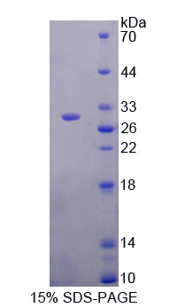 Recombinant Inhibitory Subunit Of NF Kappa B Delta (IkBd)