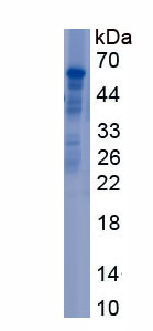 Recombinant Netrin G1 (NtnG1)