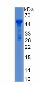 Recombinant Netrin G2 (NtnG2)