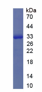 Recombinant Rho Associated Coiled Coil Containing Protein Kinase 1 (Rock1)