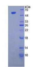 Recombinant Tubulin Beta 3 (TUBb3)