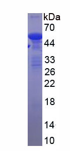 Recombinant Tubulin Alpha 1B (TUBa1B)
