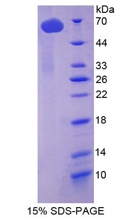 Recombinant Tubulin Delta (TUBd)