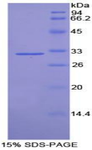 Recombinant Tubulin Delta (TUBd)
