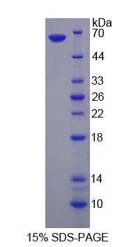 Recombinant Tau-Tubulin Kinase 2 (tTBK2)