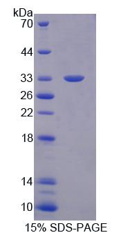 Recombinant Tubulin Folding Cofactor B (TBCB)