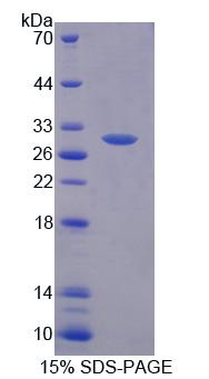 Recombinant Phosphoglucomutase 2 (PGM2)