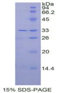 Recombinant Interleukin 31 Receptor A (IL31RA)