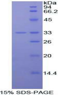 Recombinant Interleukin 20 Receptor Alpha (IL20Ra)