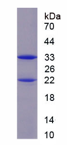 Recombinant Interleukin 20 Receptor Beta (IL20Rb)