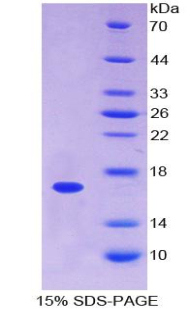 Recombinant Annexin A3 (ANXA3)