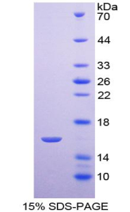 Recombinant Annexin A3 (ANXA3)