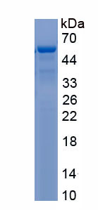 Recombinant Aldehyde Dehydrogenase 1 Family, Member A1 (ALDH1A1)