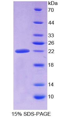 Recombinant Aldehyde Dehydrogenase 1 Family, Member A3 (ALDH1A3)