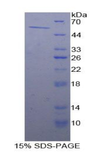 Recombinant Aldehyde Dehydrogenase 7 Family, Member A1 (ALDH7A1)