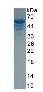 Recombinant Aldehyde Dehydrogenase 9 Family, Member A1 (ALDH9A1)