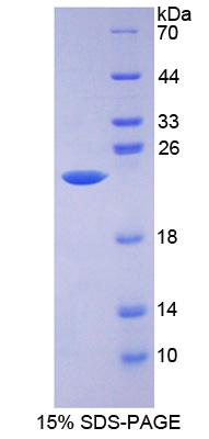 Recombinant Aldehyde Dehydrogenase 9 Family, Member A1 (ALDH9A1)