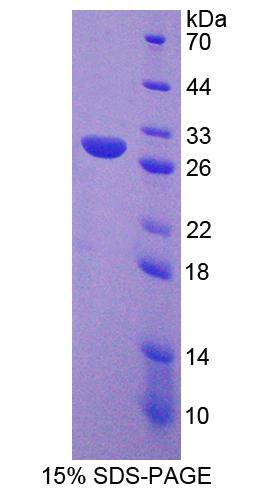 Recombinant Diacylglycerol Kinase Gamma (DGKg)