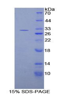 Recombinant Diacylglycerol Kinase Gamma (DGKg)