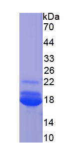 Recombinant Complement Component 1, Q Subcomponent C (C1qC)