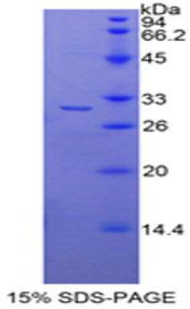 Recombinant Histone Deacetylase 6 (HDAC6)