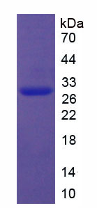 Recombinant Sirtuin 1 (SIRT1)