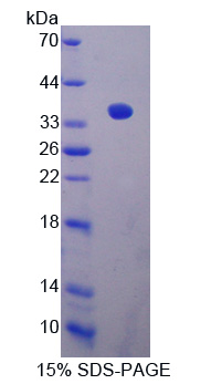 Recombinant Sirtuin 4 (SIRT4)