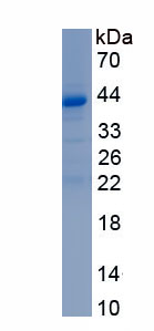 Recombinant Sirtuin 6 (SIRT6)