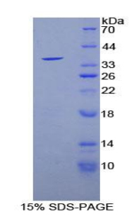 Recombinant Sirtuin 6 (SIRT6)