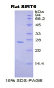 Recombinant Sirtuin 6 (SIRT6)