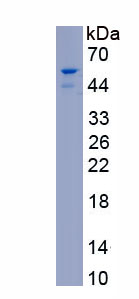 Recombinant Sirtuin 7 (SIRT7)