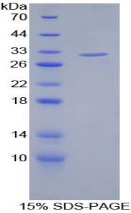 Recombinant Filamin C Gamma (FLNC)