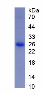 Recombinant Filamin C Gamma (FLNC)