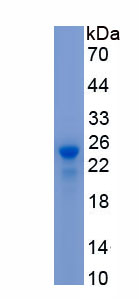 Recombinant Ring Finger Protein 128 (RNF128)