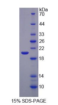 Recombinant Eukaryotic Translation Initiation Factor 2 Alpha Kinase 3 (EIF2aK3)