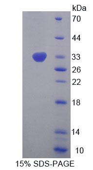 Recombinant Eukaryotic Translation Initiation Factor 2 Subunit 1 (EIF2S1)