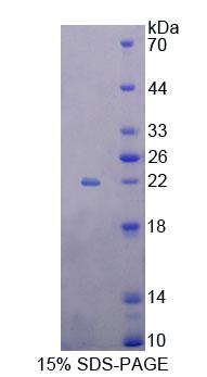 Recombinant Eukaryotic Translation Elongation Factor 1 Epsilon 1 (EEF1e1)