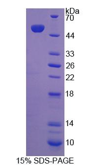 Recombinant Eukaryotic Translation Elongation Factor 1 Gamma (EEF1g)