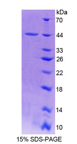 Recombinant Profilin 3 (PFN3)