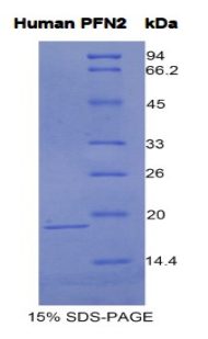 Recombinant Profilin 2 (PFN2)