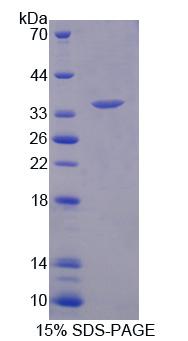 Recombinant Replication Factor C2 (RFC2)
