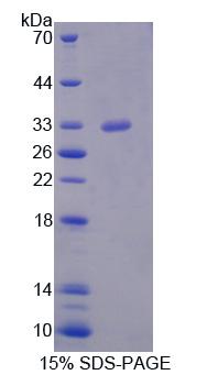 Recombinant Mediator Complex Subunit 6 (MED6)