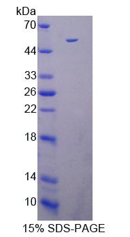 Recombinant Death Associated Protein Kinase 3 (DAPK3)