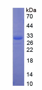 Recombinant Death Associated Protein Kinase 2 (DAPK2)
