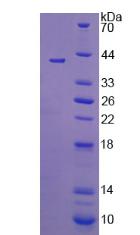 Recombinant 11-Beta-Hydroxysteroid Dehydrogenase Type 2 (HSD11b2)