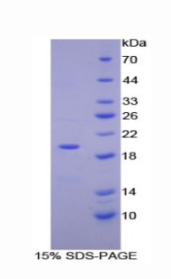 Recombinant Ectonucleotide Pyrophosphatase/Phosphodiesterase 1 (ENPP1)