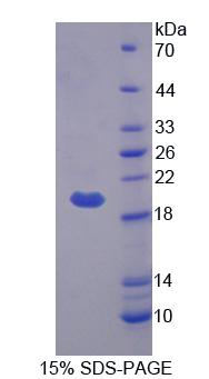 Recombinant Bestrophin 4 (BEST4)