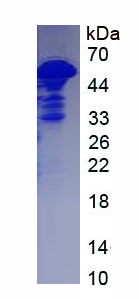 Recombinant Bestrophin 3 (BEST3)